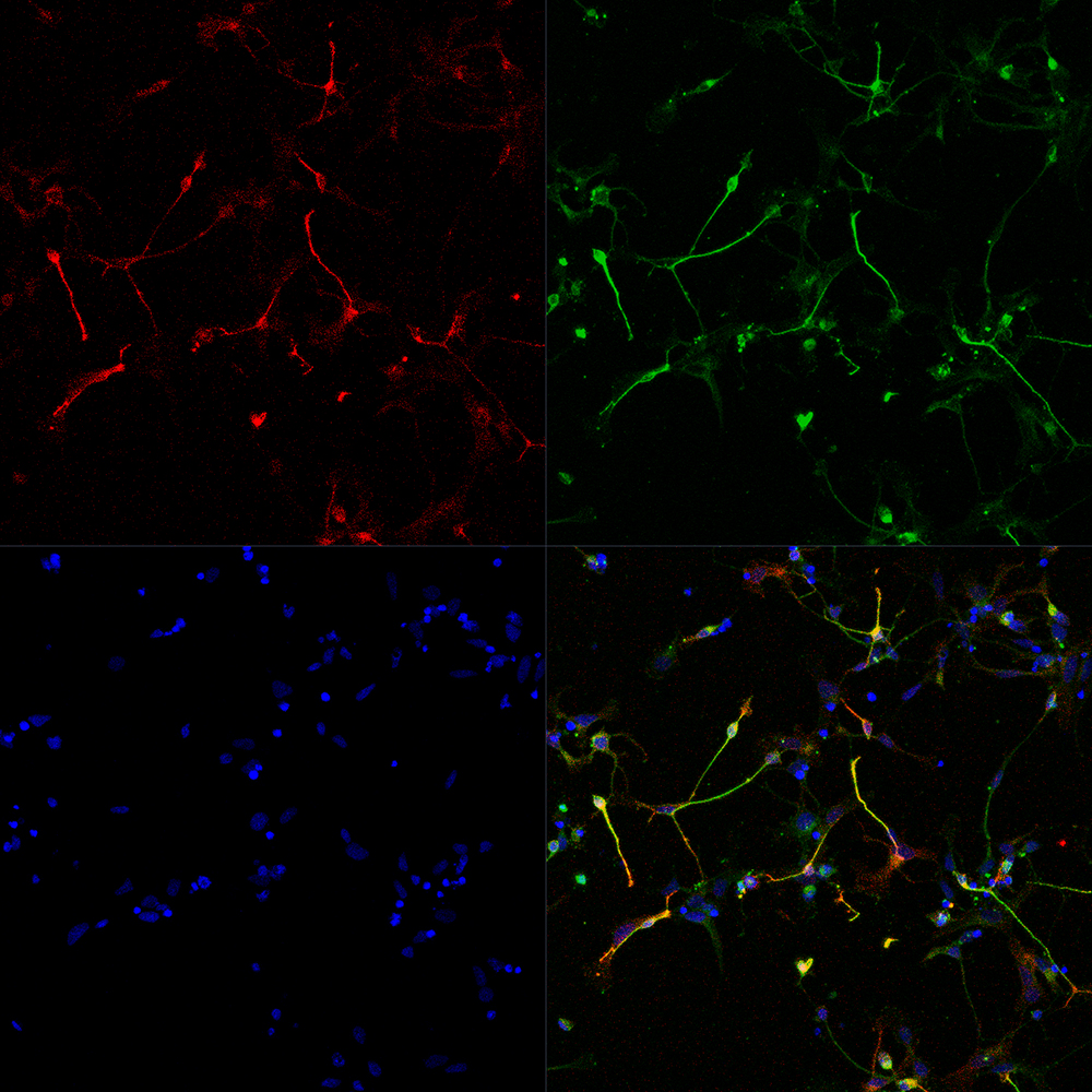 immunofluorescence